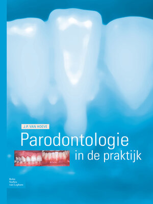 cover image of Parodontologie in de praktijk